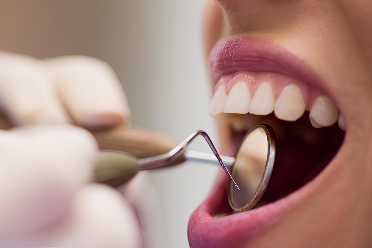 Кариес ведет к раку: стоматолог озвучил тревожную статистику